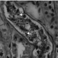 Please give me the answer to the A-level Biology Question Describe and explain the main function of the proximal convoluted tubule in filtration/absorption.